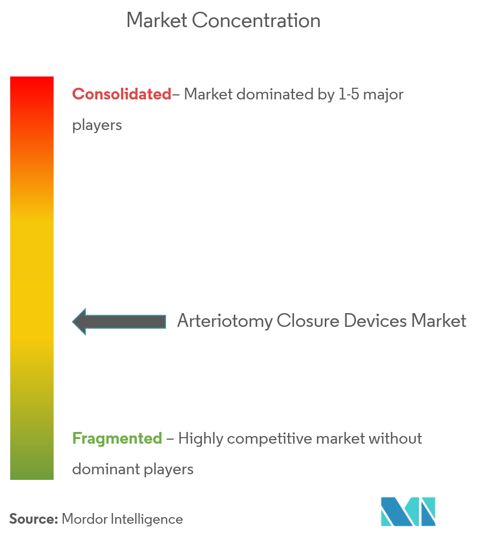 Arteriotomy Closure Devices Market Concentration